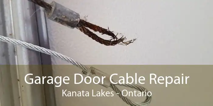 Garage Door Cable Repair Kanata Lakes - Ontario